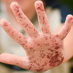 How do germs spread?