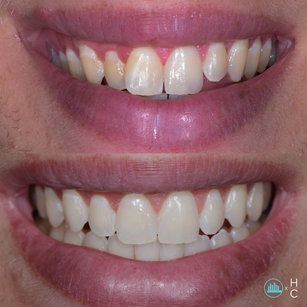 267-copyofheadshotteethtemplate-17103622195242.png