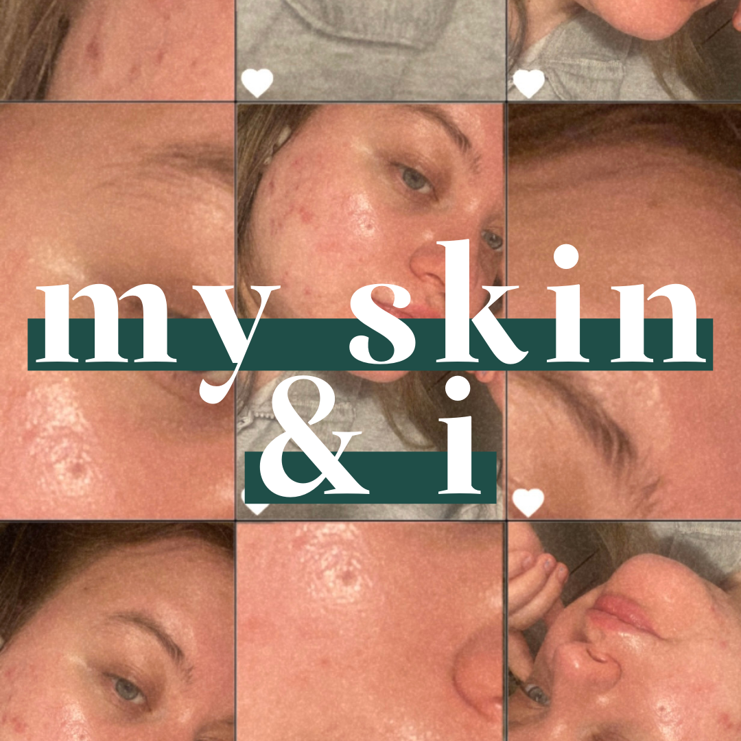 my skin & i 